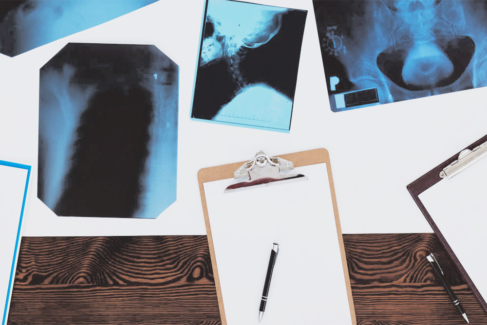 why-i-need-a-medical-power-of-attorney